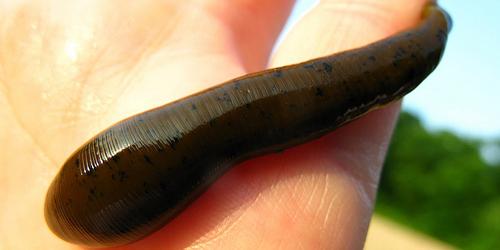 5-Pack Leeches